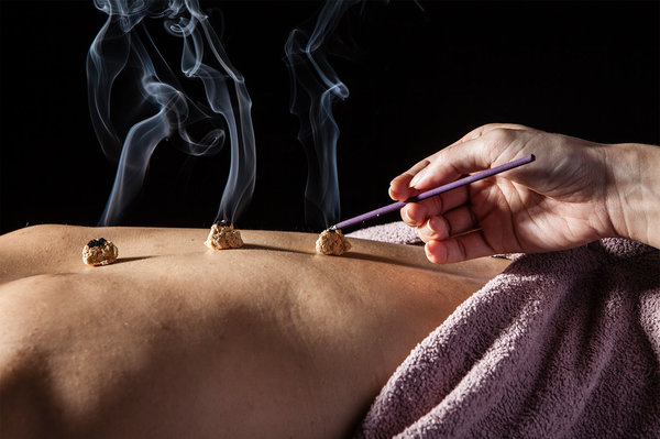 The Benefits Of Moxibustion